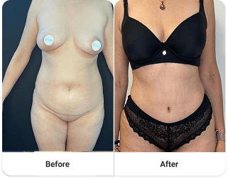 Before and after 3